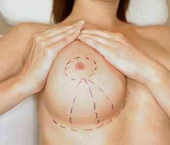 breast size reduction surgery in Delhi